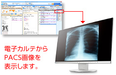 PACS連携