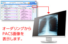 PACS連携